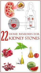 Pin On Recipes And Remedies