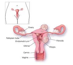 Heavy Menstrual Bleeding Cdc