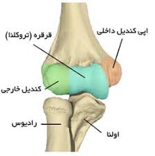 نتیجه تصویری برای شکستگی آرنج