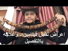 اعراض نقص فيتامين د وعلاجه واهم المصادر الغنية بافيتامين D با التفصيل تجربتي الشخصية Youtube