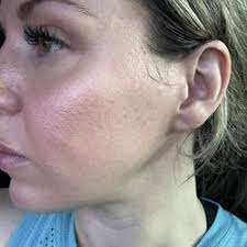 MOBILE DERMATOLOGY PC