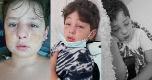 Casa Grande little boy battles serious sinus cavity infection after  COVID-19 diagnosis