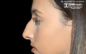 DHR Health Plastic & Reconstructive Surgery Institute (@dhrhealthplastics)  • Instagram photos and videos