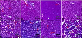 Image result for Xylia africana