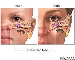 Carefully administer the recommended number of drops into the ear canal. How To Get Water Out Of My Ear And What Would Happen If It Didn T Come Out Quora