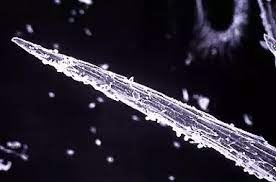 How can you tell if your allergic to birds? Is It Common For People To Be Allergic To Cacti Quora