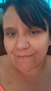 Faces of Neurofibromatosis