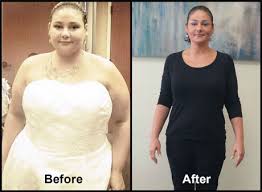 Rome Weight Loss First Doctors Weight Loss