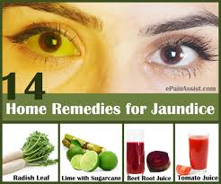 Home Remedies For Jaundice In Adults Jaundice Remedies Home Remedies Remedies