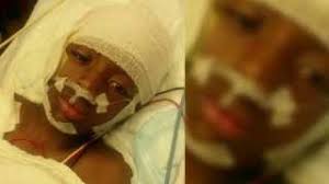 7-year-old recovering after being hit by a car