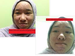 Klinik dr halim & nor. Klinik Dr Ko Kuantan