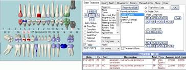 Dental Charting Tooth Surfaces Www Bedowntowndaytona Com