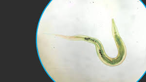 Oxiúrius | Infecção pelo verme Enterobius vermicularis