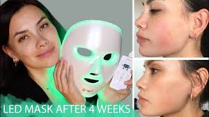 Led therapy for issues like wrinkles and acne is making dermatologists very excited. Led Mask For Rosacea Sensitive Skin Nataschap Youtube