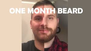 Often most guys don't start worrying until a few months in. 3 Year Hair Growth After Shaving Novocom Top