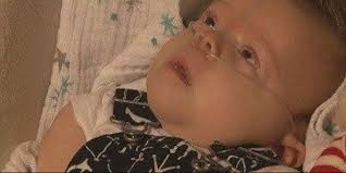 Parents of baby with genetic disorder: “He will never talk, never roll over”