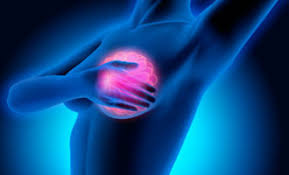 Women who've had breast cancer can still get other cancers. Esmo 2020 20 Year Research Breakthrough Offers New Hope For Breast Cancer Patients Ecancer