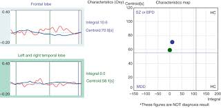Image result for Verbal Fluency Test