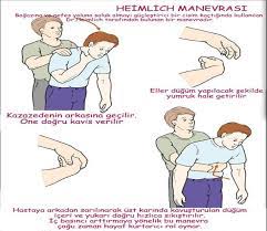 Yetişkinlerde heimlich manevrası, kazazedenin hava yolunun tam tıkanması durumunda uygulanmaktadır. Heimlich Manevrasi Ve Hayat Kurtarma Asil Susan Kaybeder