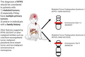 The malignant tumor of the hemangiopericytoma can extend to another bodily region, mainly the lungs and bones. Frontiers Rhabdoid Tumor Predisposition Syndrome From Clinical Suspicion To General Management Oncology