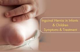 Image result for Inguinal hernia child
