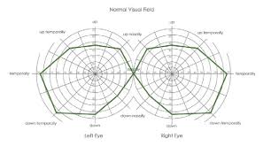 Vasrd Visual Field Chart Used To Score Visual Field For
