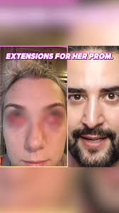 Shein False Lashes Gave Her Zombie Eyes! 👀 #reels #skin #lashes  #lashextensions #shein