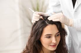 PRP For Hair Loss - The London Skin And ...