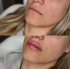 PLSTK ™️ Aesthetics