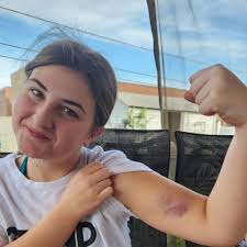 One in a million nut shot aftermath image