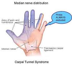 Or it could be due to some chest problem or if the pain is more towards the left breast , it could source: Tingling Right Hand With Ache In Arm Arm Pit And Front Right Of Chest And Pain In Back By Shoulder Blade And Side Of Neck