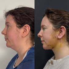 Op.Dr. Cem Berkay SINACI