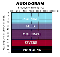 Types Of Hearing Loss And Common Causes Bohol Philippines