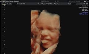 How Much Are 4d Scans In 2020 Baby Scan Baby Ultrasound Pictures 4d Ultrasound