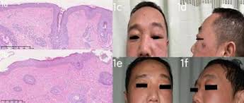 Frontiers in Immunology