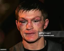 110 Juan Lazcano Photos & High Res Pictures