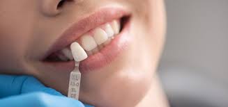 Some or all of these costs may be covered by dental insurance. How Much Does It Cost For Tooth Filling North York Dental Clinic