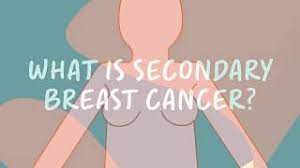 A sudden, noticeable new pain is the most common symptom of cancer that has spread to the bone. Secondary Breast Cancer In The Bone