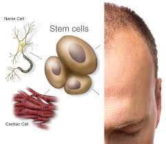 Stem Cells To Create Hair Regrowth