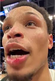 Dame Lillard's Game Winning Shot Analysis