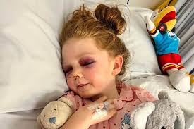 Girl, 8, suffered brain injury after being hit by zorb ball