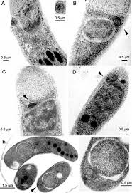 Cryptosporidium parvum (formerly known as c. Characterization Of A Mitochondrion Like Organelle In Cryptosporidium Parvum Parasitology Cambridge Core