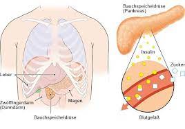 Diabetes Typ 1 Gesundheitsinformation De