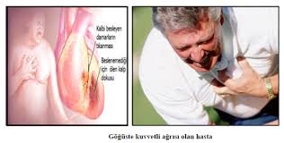 Gogsum Neden Agriyor