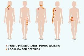 A fibromialgia é uma condição médica que é caracterizada pela dor generalizada em todo o corpo. Fibromialgia Ou Dor Miofascial Encontrar Grupar