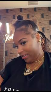 Box Braids with Alopecia