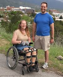 The image is available for download in high resolution quality up to 4518x5052. Body Integrity Identity Disorder Has Made Chloe Jennings White 58 Disown Her Legs Daily Mail Online