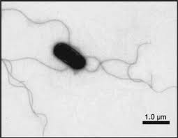 Image result for Rhizobium radiobacter, syn. Agrobacterium tumefaciens