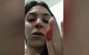 Mulher denuncia que foi agredida por homem que conheceu pela web e mantinha  relacionamento, em Itumbiara