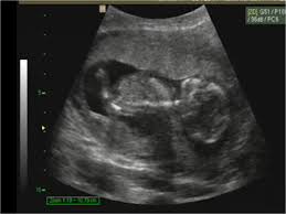 Tngo 14 Semanas Y No Se Me Nota Nda Embarazadas Primerizas Babycenter